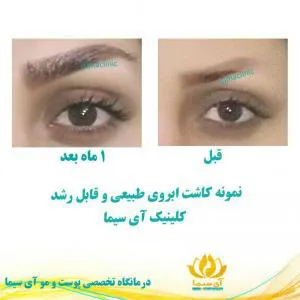 کلینیک آی سیما